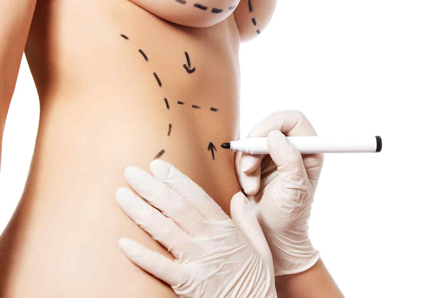 https://zahaaesthetic.com/wp-content/uploads/2017/08/cosmetic-surgery-blog-11.jpg